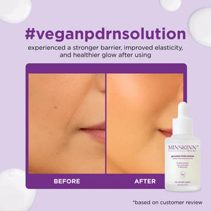 Before and after skin comparison with Vegan PDRN Serum with Centella Bakuchiol Ceramides