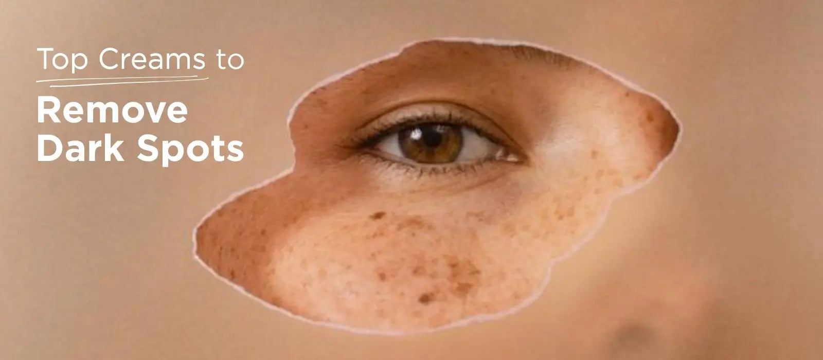 Best Dark Spot Removal Creams in India
