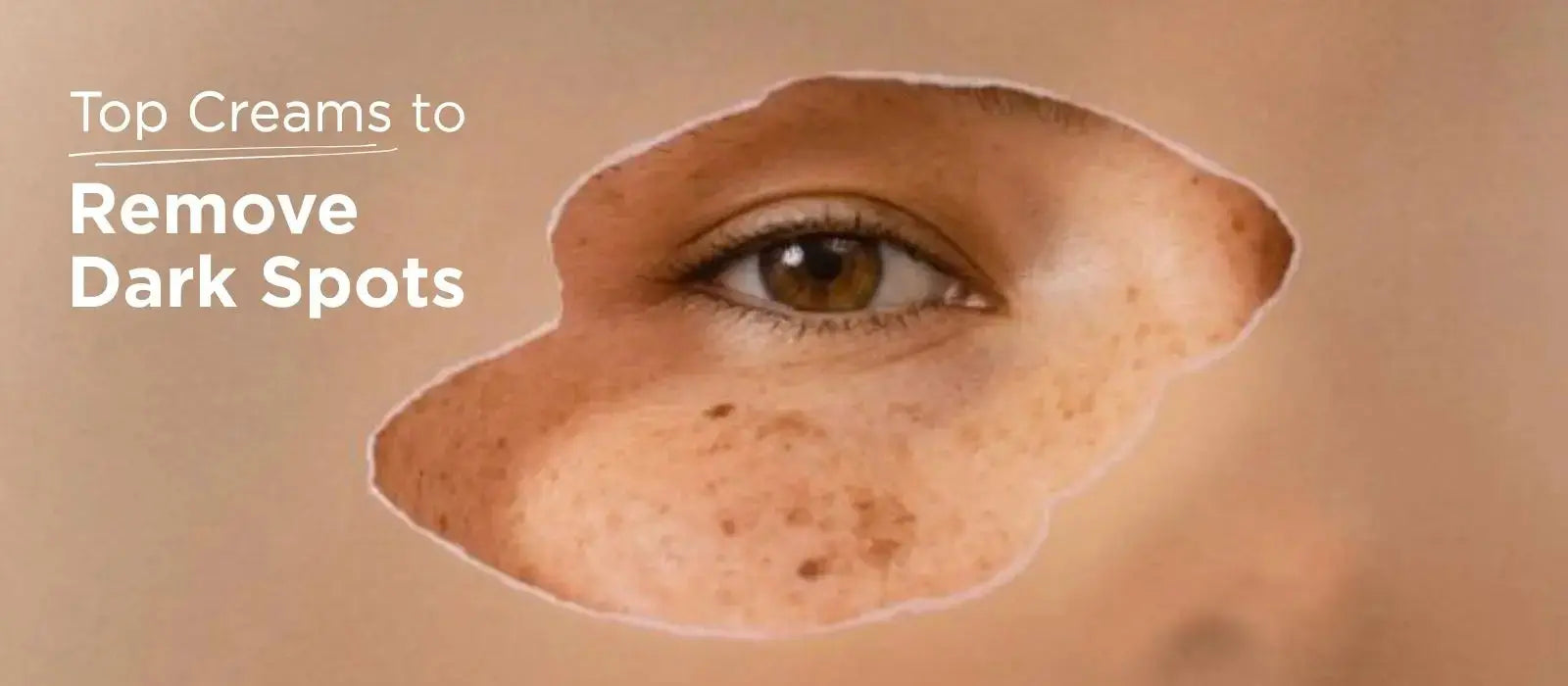 Best Dark Spot Removal Creams in India