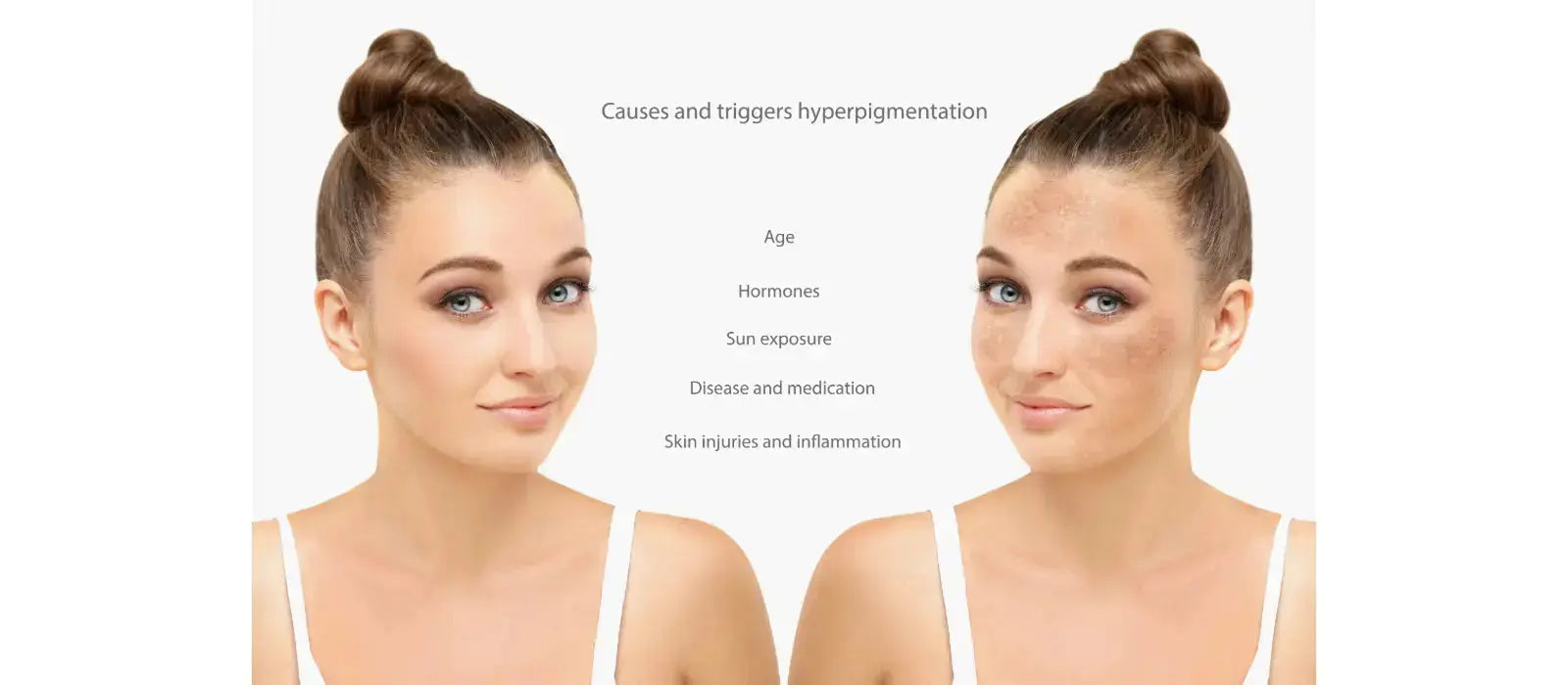 dark spot removal routine