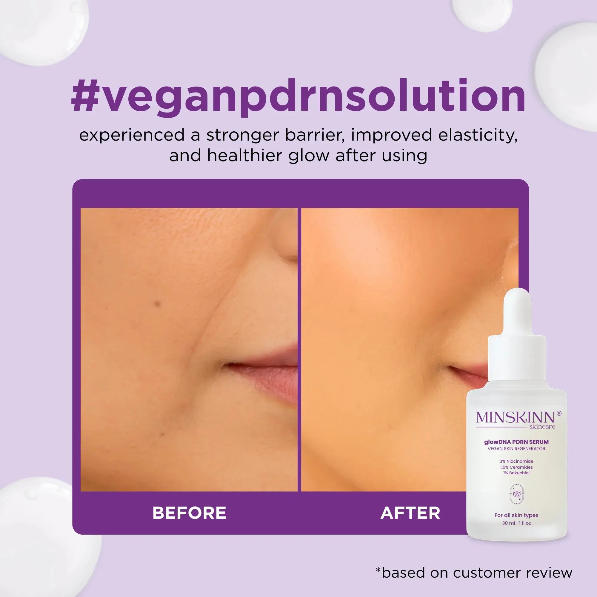Vegan PDRN Serum with Centella Bakuchiol Ceramides 