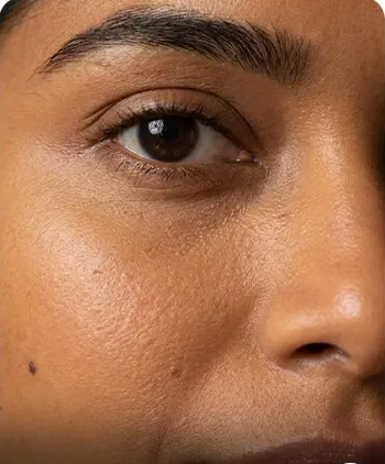 Aging skin concern